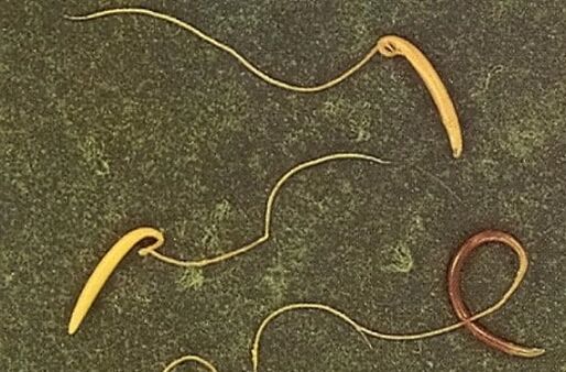 ostorféreg az emberi testből