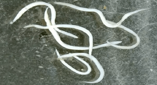 pinworms az emberi szervezetben