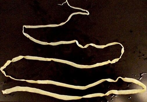 széles galandféreg az emberi testből