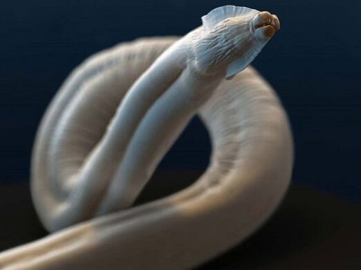 toxocara az emberi szervezetből