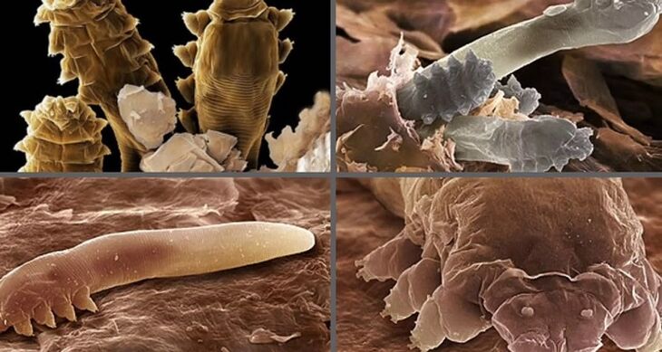 az emberi bőrparaziták típusai