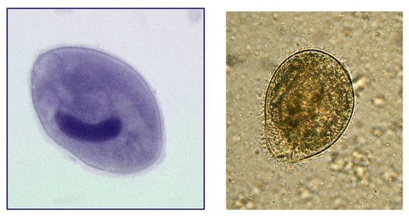 Balantidia ciliates, a vastagbélben élősködik